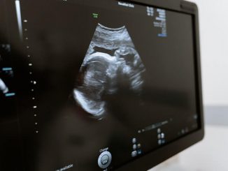 Zbog čega mnogi 11. nedelju trudnoće smatraju ključnom?